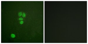 Anti-SOX9 antibody produced in rabbit affinity isolated antibody
