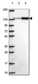 Anti-SMC2 antibody produced in rabbit Prestige Antibodies® Powered by Atlas Antibodies, affinity isolated antibody, buffered aqueous glycerol solution