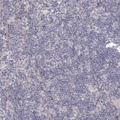Anti-TACC2 antibody produced in rabbit Prestige Antibodies® Powered by Atlas Antibodies, affinity isolated antibody, buffered aqueous glycerol solution