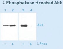 Anti-Phosphoserine Antibody, clone 4A4 (mouse IgG1) clone 4A4, Upstate®, from mouse