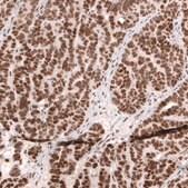 Monoclonal Anti-Smarcb1 Antibody Produced In Mouse Prestige Antibodies® Powered by Atlas Antibodies, clone CL13992, affinity isolated antibody, buffered aqueous glycerol solution