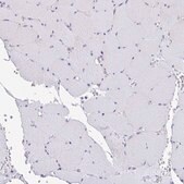 Anti-MYH10 antibody produced in rabbit Prestige Antibodies® Powered by Atlas Antibodies, affinity isolated antibody, buffered aqueous glycerol solution
