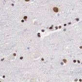 Anti-SF3A1 antibody produced in rabbit Prestige Antibodies® Powered by Atlas Antibodies, affinity isolated antibody, buffered aqueous glycerol solution