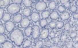 Anti-PAK-1 Antibody, clone 1H5 ZooMAb® Rabbit Monoclonal recombinant, expressed in HEK 293 cells