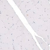 Monoclonal Anti-CDKL5 antibody produced in mouse Prestige Antibodies® Powered by Atlas Antibodies, clone CL4881, purified immunoglobulin, buffered aqueous glycerol solution