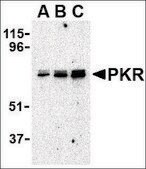Anti-PKR antibody produced in rabbit affinity isolated antibody, buffered aqueous solution