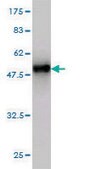 Monoclonal Anti-UCHL1 antibody produced in mouse clone 1B8-4D2, purified immunoglobulin, buffered aqueous solution