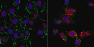 Anti-60S RPL5 from rabbit, purified by affinity chromatography