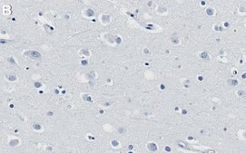 Anti-Renin Receptor Antibody, clone 1C22 ZooMAb® Rabbit Monoclonal recombinant, expressed in HEK 293 cells