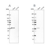 Anti-MS4A1 antibody produced in rabbit Prestige Antibodies® Powered by Atlas Antibodies, affinity isolated antibody, buffered aqueous glycerol solution