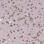 Anti-MTDH antibody produced in rabbit Prestige Antibodies® Powered by Atlas Antibodies, affinity isolated antibody, buffered aqueous glycerol solution