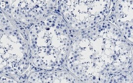 Anti-SMARCA2 Antibody, clone 3E14 ZooMAb® Rabbit Monoclonal recombinant, expressed in HEK 293 cells