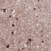 Anti-GAD1 antibody produced in rabbit Prestige Antibodies® Powered by Atlas Antibodies, affinity isolated antibody, buffered aqueous glycerol solution