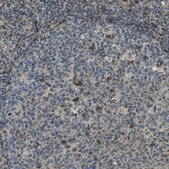 Anti-LEMD2 antibody produced in rabbit Prestige Antibodies® Powered by Atlas Antibodies, affinity isolated antibody, buffered aqueous glycerol solution