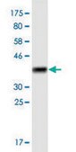 Monoclonal Anti-SLC25A25 antibody produced in mouse clone 4D8, purified immunoglobulin, buffered aqueous solution