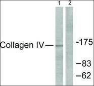 Anti-Collagen IV antibody produced in rabbit affinity isolated antibody
