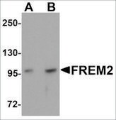 Anti-FREM2 antibody produced in rabbit affinity isolated antibody, buffered aqueous solution