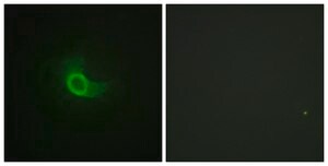 Anti-CD130 antibody produced in rabbit affinity isolated antibody