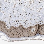 Anti-PSMC5 antibody produced in rabbit Prestige Antibodies® Powered by Atlas Antibodies, affinity isolated antibody, buffered aqueous glycerol solution