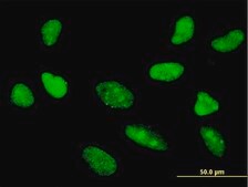 Monoclonal Anti-TCF7 antibody produced in mouse clone 1D2, purified immunoglobulin, buffered aqueous solution