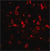 抗-TSLP (ab3) 兔抗 affinity isolated antibody