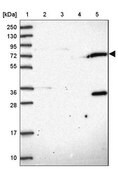 Anti-TRIM3 antibody produced in rabbit Prestige Antibodies® Powered by Atlas Antibodies, affinity isolated antibody, buffered aqueous glycerol solution