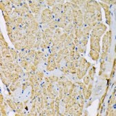 Anti-Hexokinase II antibody produced in rabbit