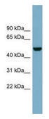 Anti-CSF1 antibody produced in rabbit affinity isolated antibody