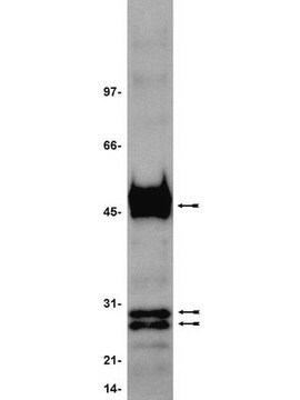 Anti-Histidine Tagged Antibody, clone 4D11 clone 4D11, Upstate&#174;, from mouse
