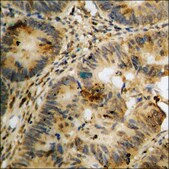 Anti-phospho-PDK1 (pSer241) antibody produced in rabbit affinity isolated antibody