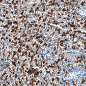 Monoclonal Anti-HMOX1 antibody produced in mouse Prestige Antibodies® Powered by Atlas Antibodies, clone CL11661, purified immunoglobulin, buffered aqueous glycerol solution