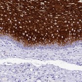 Anti-A2ML1 antibody produced in rabbit Prestige Antibodies® Powered by Atlas Antibodies, affinity isolated antibody, buffered aqueous glycerol solution
