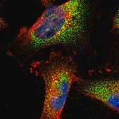 Anti-TRPC1 antibody produced in rabbit Prestige Antibodies® Powered by Atlas Antibodies, affinity isolated antibody, buffered aqueous glycerol solution