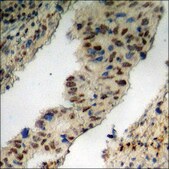 Anti-phospho-MEF2D (pSer444) antibody produced in rabbit affinity isolated antibody