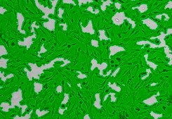 OSUMMER.9 Mouse NRAS-Mutant Melanoma Cell Line