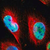Anti-CLOCK antibody produced in rabbit Prestige Antibodies® Powered by Atlas Antibodies, affinity isolated antibody, buffered aqueous glycerol solution