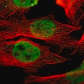 Anti-HSF1 antibody produced in rabbit Prestige Antibodies® Powered by Atlas Antibodies, affinity isolated antibody, buffered aqueous glycerol solution