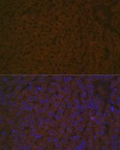 Anti-Haptoglobin (HP) antibody produced in rabbit