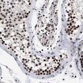 Anti-SMARCB1 antibody produced in rabbit Prestige Antibodies® Powered by Atlas Antibodies, affinity isolated antibody, buffered aqueous glycerol solution