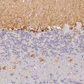 Anti-CBS antibody produced in rabbit Prestige Antibodies® Powered by Atlas Antibodies, affinity isolated antibody, buffered aqueous glycerol solution