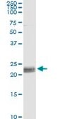 Monoclonal Anti-CD8A antibody produced in mouse clone 4B9, purified immunoglobulin, buffered aqueous solution