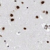 Anti-SF3A1 antibody produced in rabbit Prestige Antibodies® Powered by Atlas Antibodies, affinity isolated antibody, buffered aqueous glycerol solution