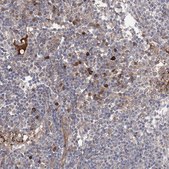 Anti-OTUD1 antibody produced in rabbit Prestige Antibodies® Powered by Atlas Antibodies, affinity isolated antibody, buffered aqueous glycerol solution