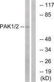 Anti-PAK1 antibody produced in rabbit affinity isolated antibody