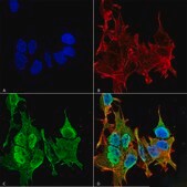 Monoclonal Anti-Gaba-B Receptor 2 - Biotin antibody produced in mouse clone S81-2, purified immunoglobulin