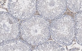 Anti-Actin Antibody, clone C4 ZooMAb® Mouse Monoclonal recombinant, expressed in HEK 293 cells