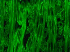 Monoclonal Anti-Dystrophin antibody produced in mouse clone MANDYS8, ascites fluid