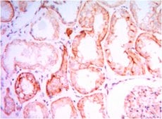 Anti-PTH1R Antibody, clone 4D2 ascites fluid, clone 4D2, from mouse