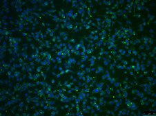 OSUMMER.1 Mouse NRAS-Mutant Melanoma Cell Line