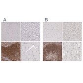 Anti-ARHGAP4 antibody produced in rabbit Ab1, Prestige Antibodies® Powered by Atlas Antibodies, affinity isolated antibody, buffered aqueous glycerol solution